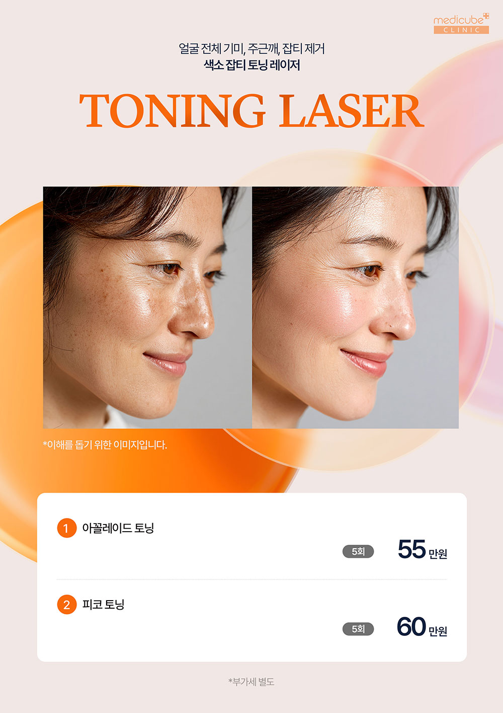 토닝1000.jpg