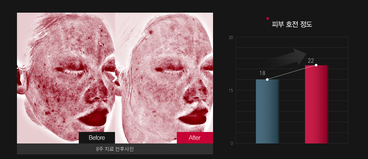 붉은기 & 피부 민감도 호전정도