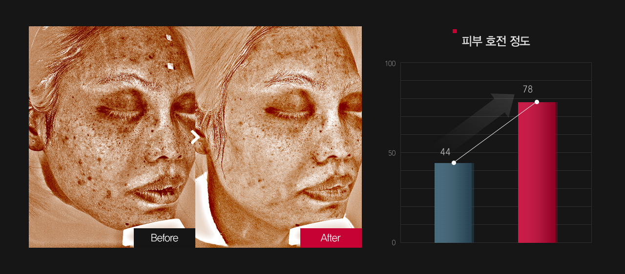 잡티 & 반점 호전정도