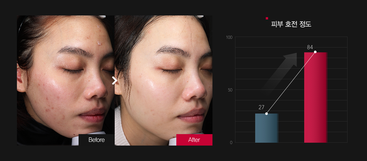 잡티 & 반점 호전정도