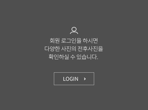 회원 로그인을 하시면 다양한 사진의 전후사진을 확인하실 수 있습니다. LOGIN 하기